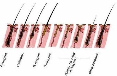 Permanent Hair Removal